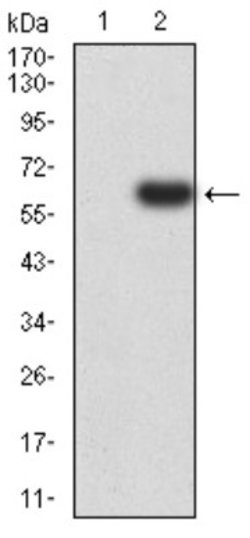 PTPN14/PTPD2 Antibody (2C12E3) - BSA Free, Novus Biologicals 0.1 ml; Unconjugated:Antibodies,